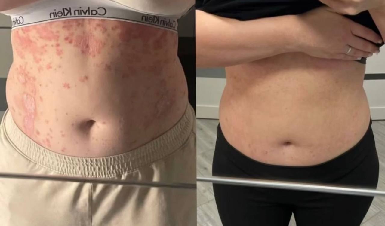 Before and after: appearance and condition of body skin